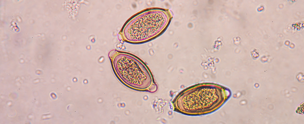 Parasites in Tap Water: What You Should Know