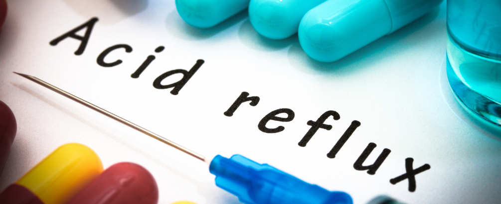 What to Drink for Acid Reflux?