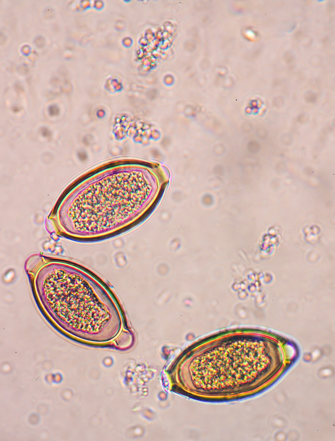 Parasites in Tap Water: What You Should Know