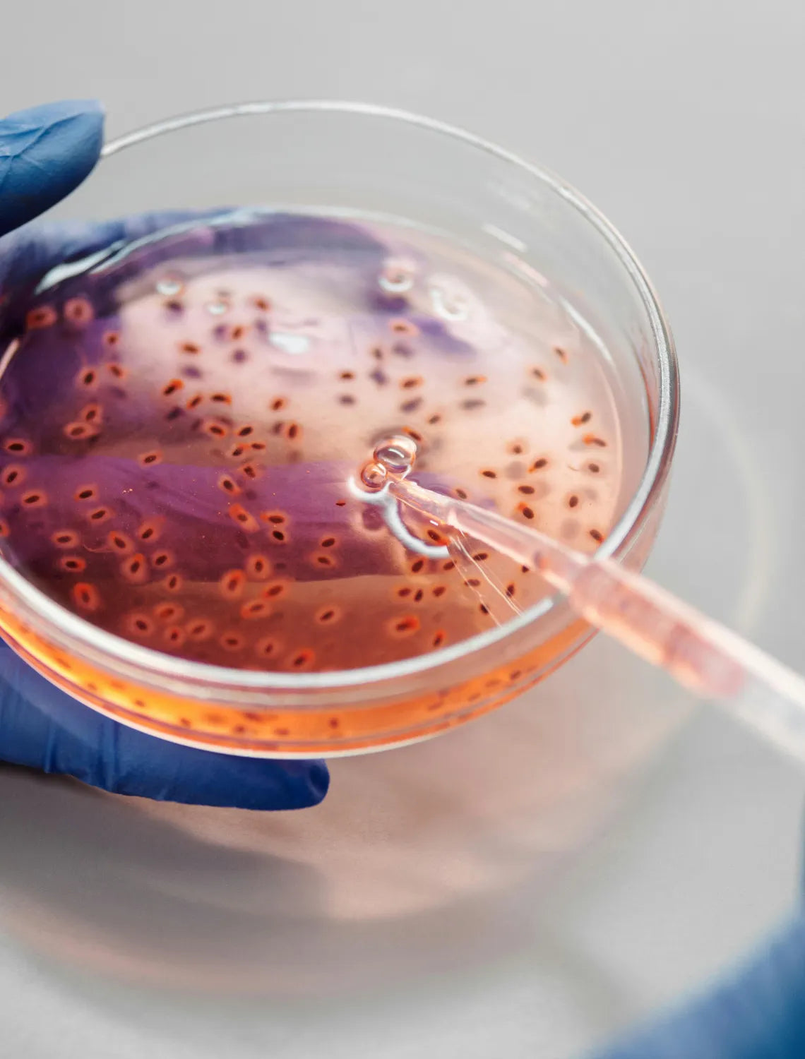 Brain-Eating Amoeba: What People in the UK Need to Know